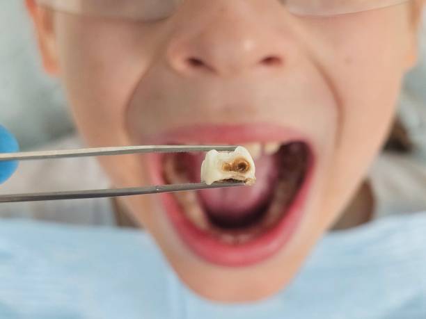 Best Urgent Tooth Repair  in South Run, VA